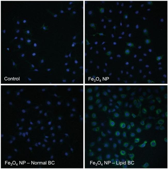 CD106 (VCAM-1) Antibody in Immunocytochemistry (ICC/IF)