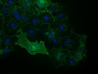 VCAM1 Antibody in Immunocytochemistry (ICC/IF)