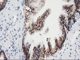 VCAM1 Antibody in Immunohistochemistry (Paraffin) (IHC (P))