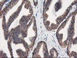 VCAM1 Antibody in Immunohistochemistry (Paraffin) (IHC (P))