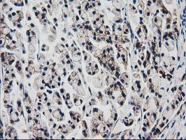 VCAM1 Antibody in Immunohistochemistry (Paraffin) (IHC (P))