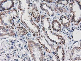 VCAM1 Antibody in Immunohistochemistry (Paraffin) (IHC (P))