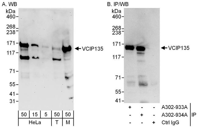 VCIP135 Antibody in Western Blot (WB)