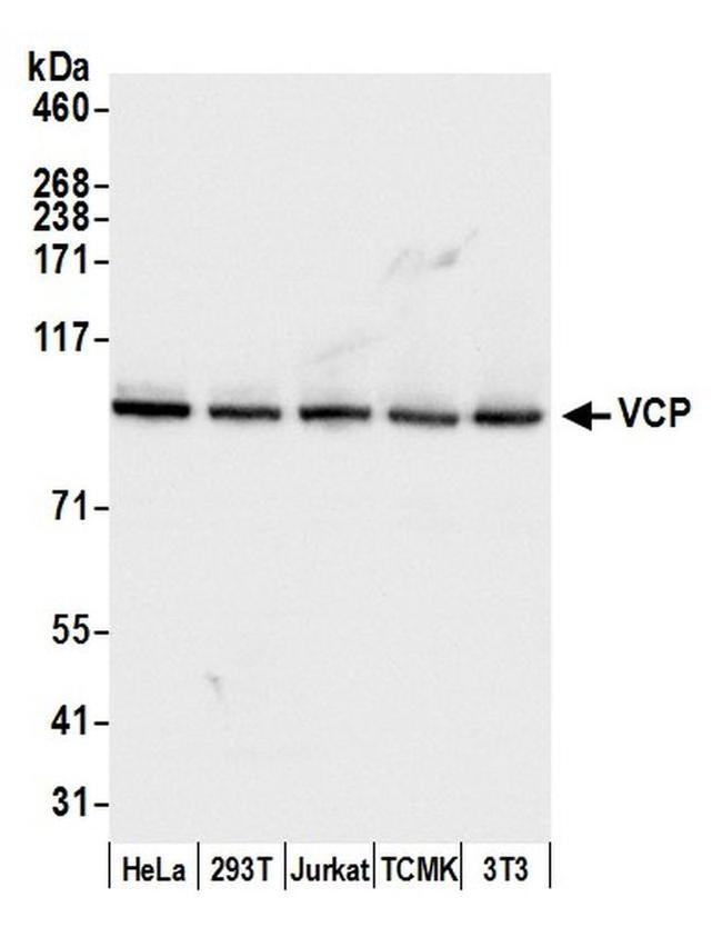 Vcp Polyclonal Antibody A300 589a T