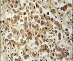 VCX Antibody in Immunohistochemistry (IHC)