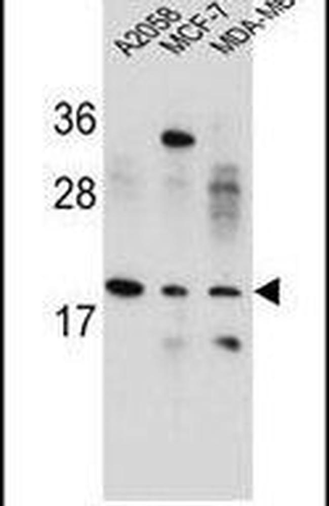 VCX Antibody in Western Blot (WB)