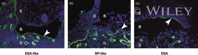 Collagen IV Antibody in Immunohistochemistry (IHC)