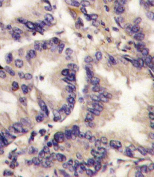 VEGFC Antibody in Immunohistochemistry (IHC)