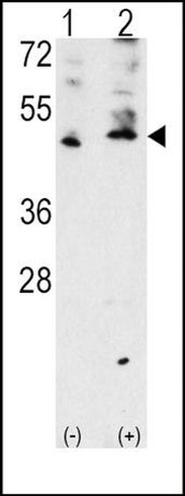 VEGFC Antibody in Western Blot (WB)