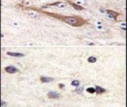 VSNL1 Antibody in Immunohistochemistry (IHC)