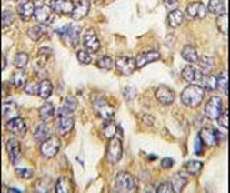 VSNL1 Antibody in Immunohistochemistry (IHC)