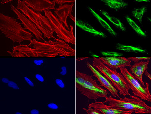 VIM Antibody in Immunocytochemistry (ICC/IF)