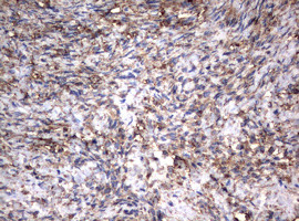 VIM Antibody in Immunohistochemistry (Paraffin) (IHC (P))