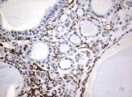 VIM Antibody in Immunohistochemistry (Paraffin) (IHC (P))