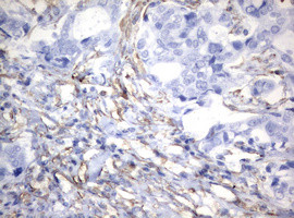 VIM Antibody in Immunohistochemistry (Paraffin) (IHC (P))