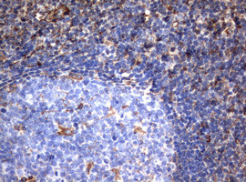 VIM Antibody in Immunohistochemistry (Paraffin) (IHC (P))