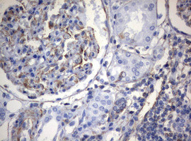 VIM Antibody in Immunohistochemistry (Paraffin) (IHC (P))