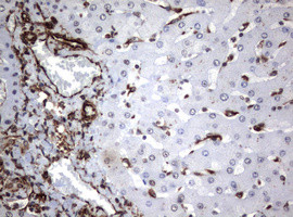 VIM Antibody in Immunohistochemistry (Paraffin) (IHC (P))