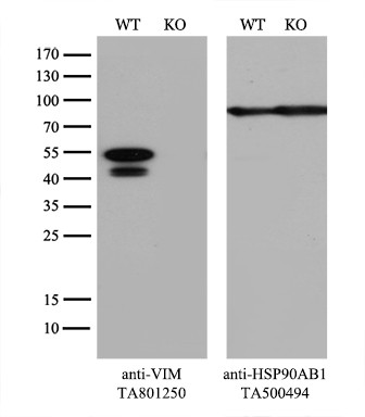 VIM Antibody