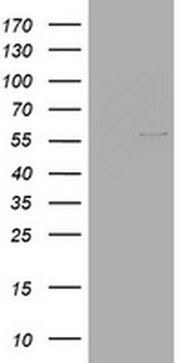 VIM Antibody in Western Blot (WB)