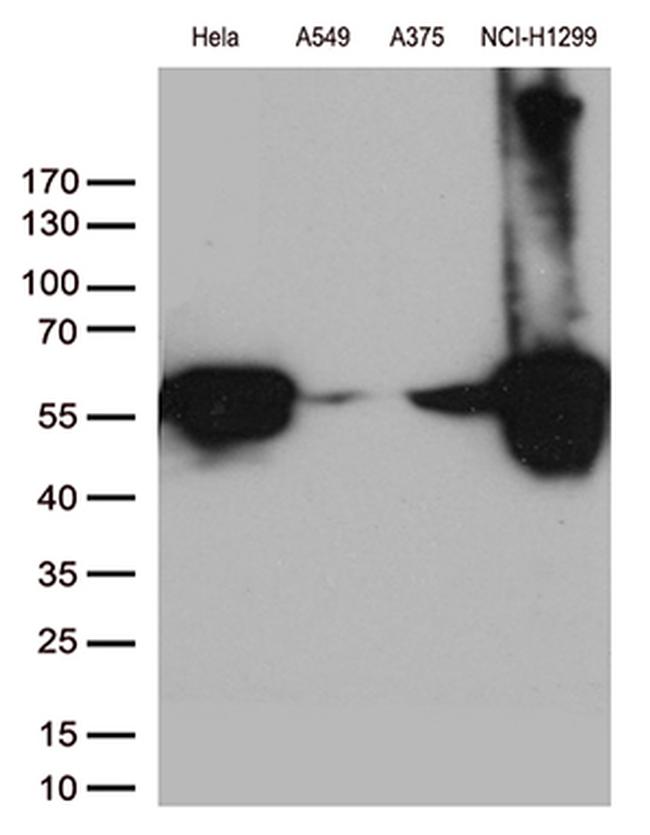 VIM Antibody in Western Blot (WB)