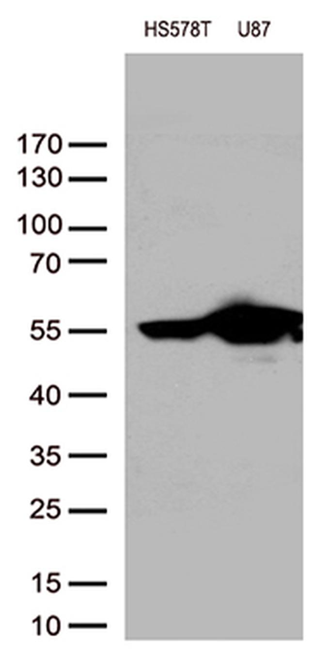 VIM Antibody in Western Blot (WB)