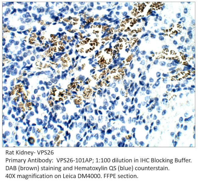 VPS26 Antibody in Immunohistochemistry (IHC)