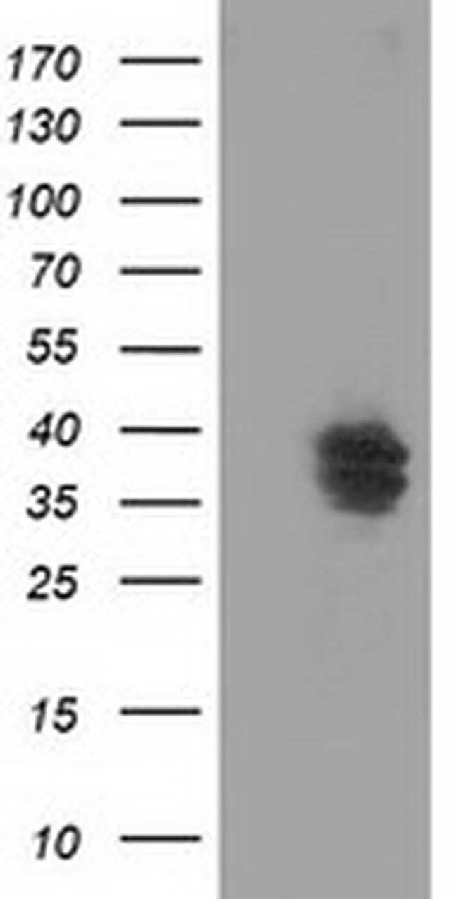 VSIG2 Antibody in Western Blot (WB)