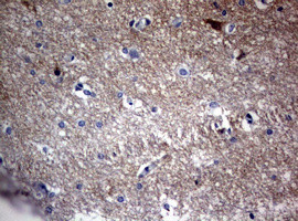 VSNL1 Antibody in Immunohistochemistry (Paraffin) (IHC (P))