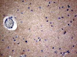 VSNL1 Antibody in Immunohistochemistry (Paraffin) (IHC (P))