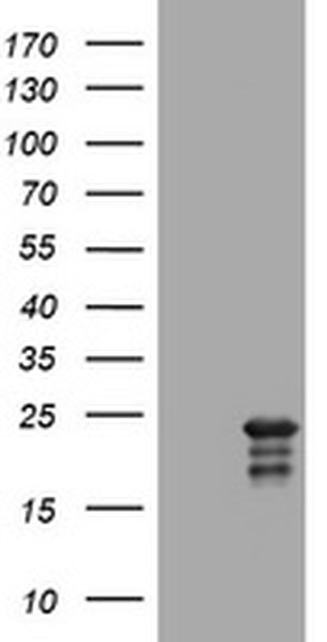 VSNL1 Antibody in Western Blot (WB)