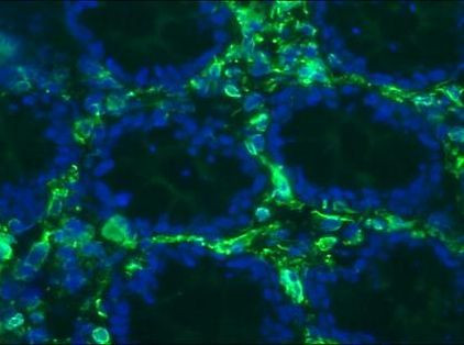 Vimentin Antibody in Immunohistochemistry (Frozen) (IHC (F))