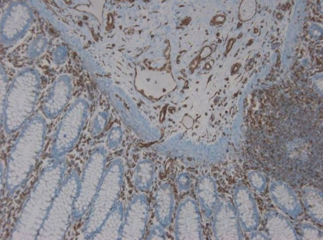 Vimentin Antibody in Immunohistochemistry (Paraffin) (IHC (P))