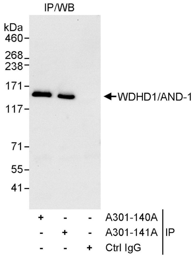 WDHD1/AND-1 Antibody in Immunoprecipitation (IP)