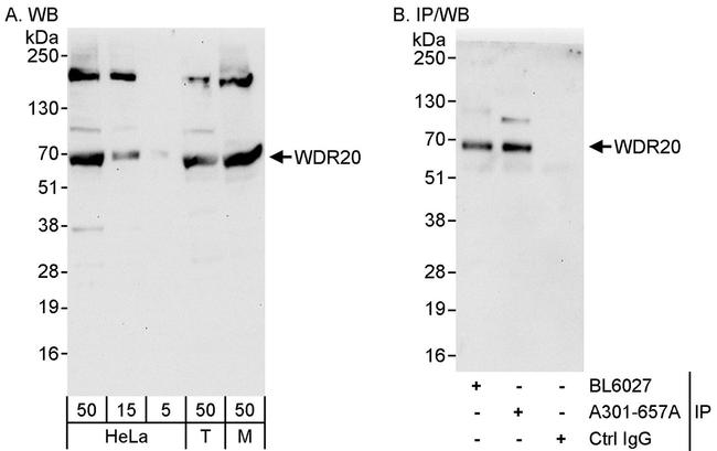 WDR20 Antibody in Western Blot (WB)