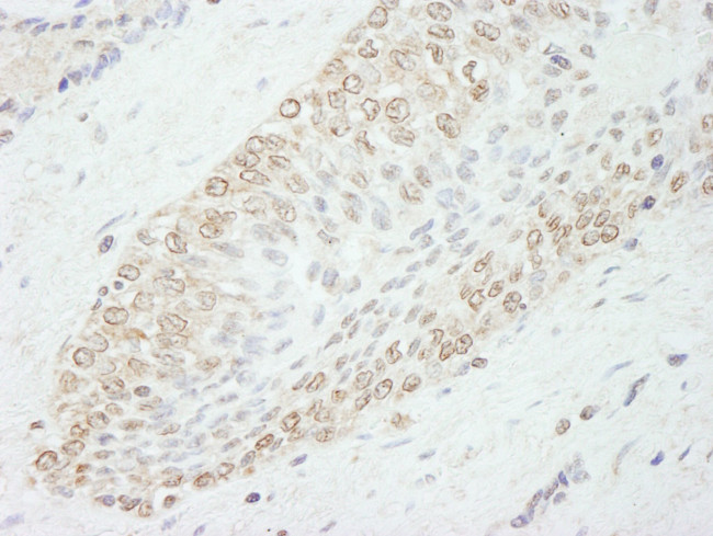 WDR91 Antibody in Immunohistochemistry (IHC)