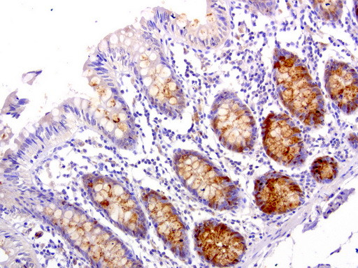 WFDC2 Antibody in Immunohistochemistry (Paraffin) (IHC (P))