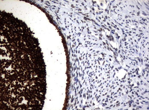 WFDC2 Antibody in Immunohistochemistry (Paraffin) (IHC (P))