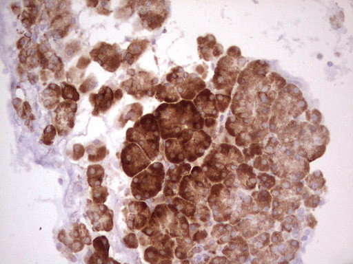 WIBG Antibody in Immunohistochemistry (Paraffin) (IHC (P))