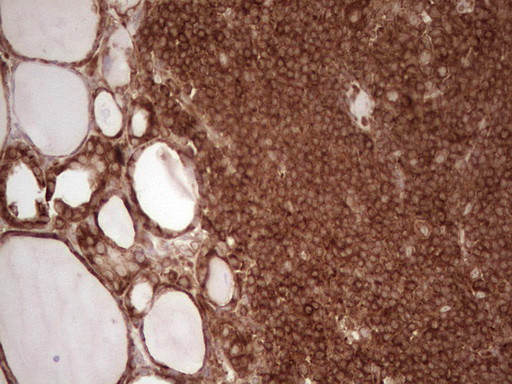 WIBG Antibody in Immunohistochemistry (Paraffin) (IHC (P))