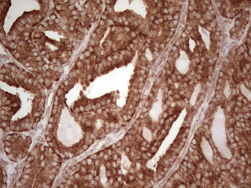 WIBG Antibody in Immunohistochemistry (Paraffin) (IHC (P))