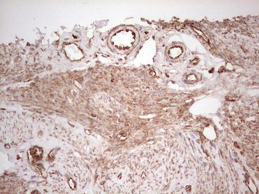 WIBG Antibody in Immunohistochemistry (Paraffin) (IHC (P))