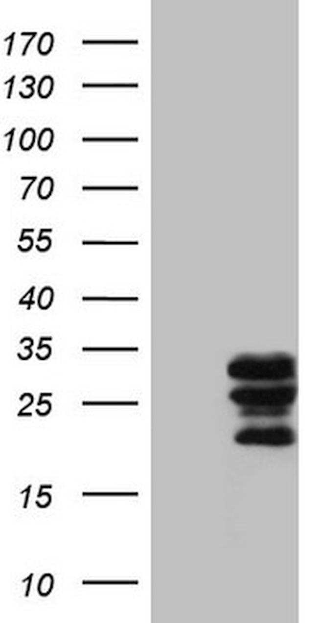 WIBG Antibody in Western Blot (WB)