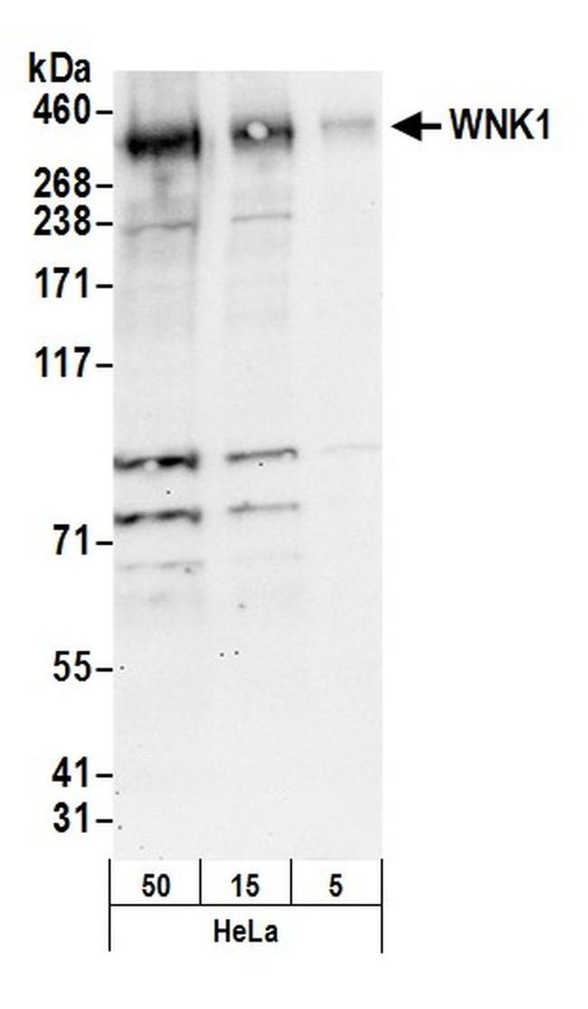 WNK1 Antibody in Western Blot (WB)