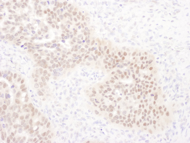 WRNIP1 Antibody in Immunohistochemistry (IHC)