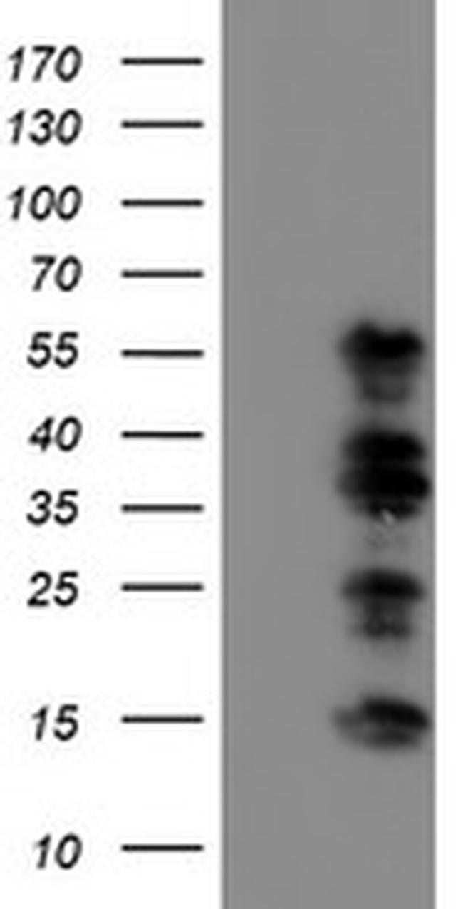 WWTR1 Antibody in Western Blot (WB)