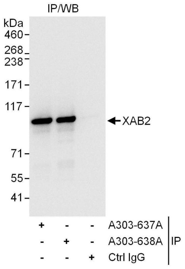 XAB2 Antibody in Immunoprecipitation (IP)