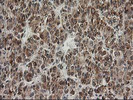 XPF Antibody in Immunohistochemistry (Paraffin) (IHC (P))