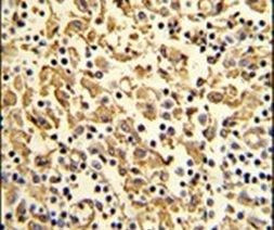 XPOT Antibody in Immunohistochemistry (IHC)