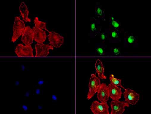 XRCC1 Antibody in Immunocytochemistry (ICC/IF)